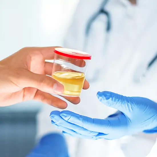 glucose urine postprandial test